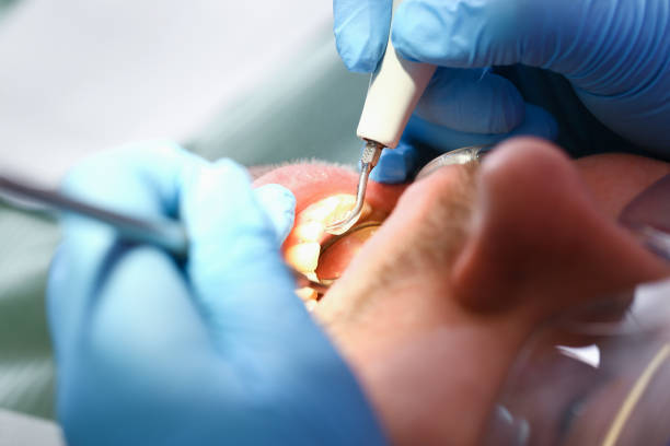 Best Broken or Cracked Tooth Emergency Dentist in Elephant Butte, NM