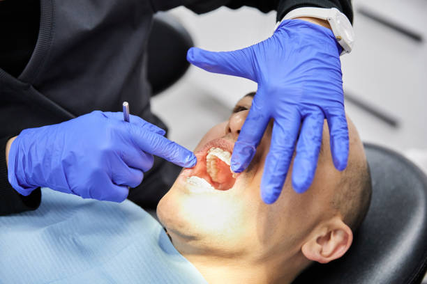 Best Emergency Dentist for Lost Fillings or Crowns in Elephant Butte, NM